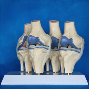 Human Knee Joint Medical Educational Skeleton Model (R020904)